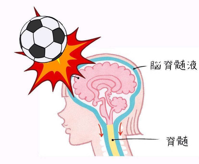 脳への衝撃の図